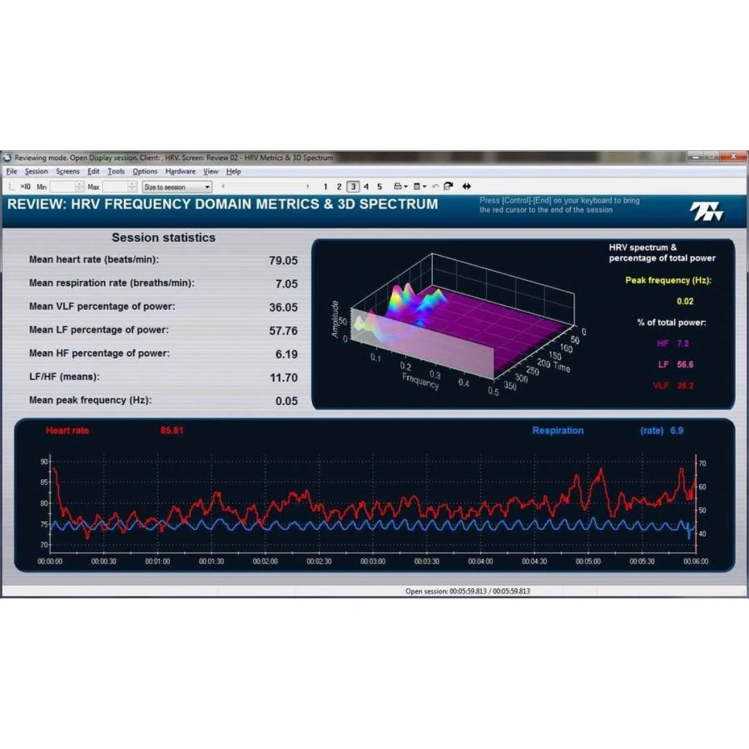 System RSA Biofeedback - obrazek 3